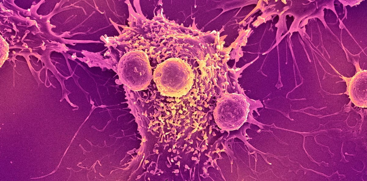 Study finds COVID-19 mRNA vaccines may prompt immune system to target cancer cells